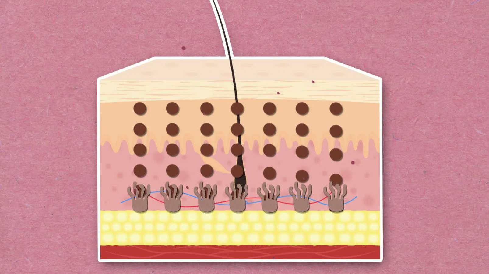 Proč mají někteří lidé pihy?