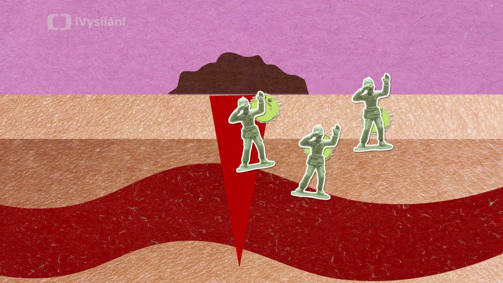 Jak naše tělo opravuje rány?